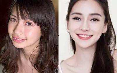 龅牙娱乐吃瓜,揭秘娱乐圈吃瓜背后的真相与笑料